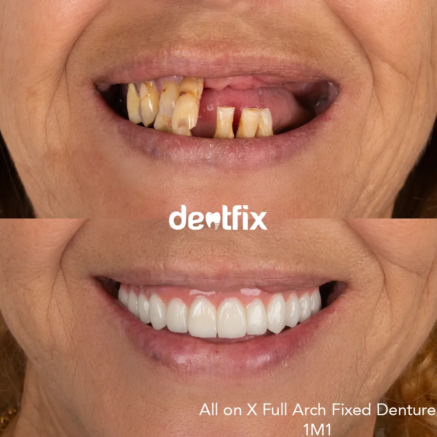 Dentfix clinic