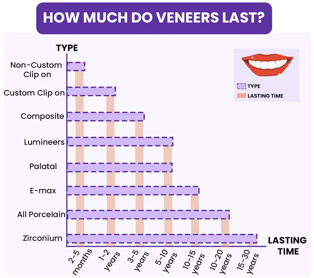 how much do veneers last