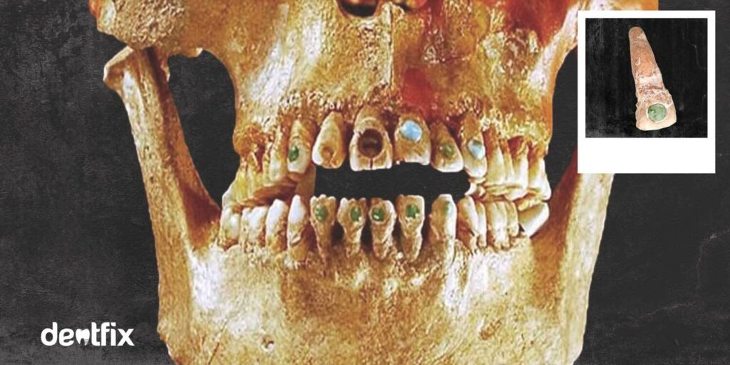 Gemas dentales: ¿Es seguro sumarse a esta tendencia?