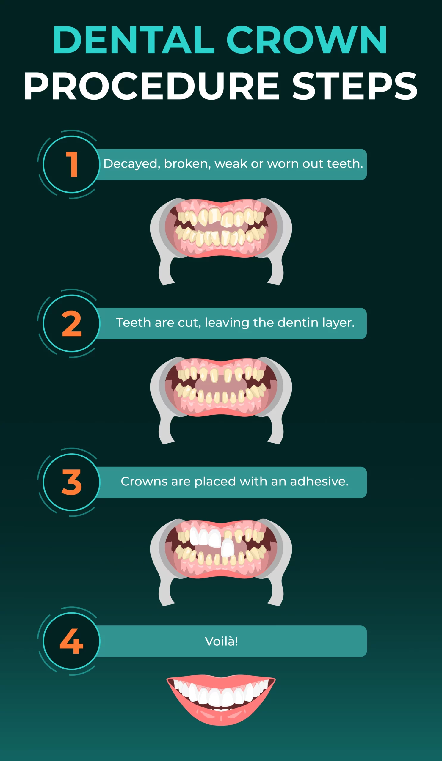 DENTAL CROWN PROCEDURE STEPS