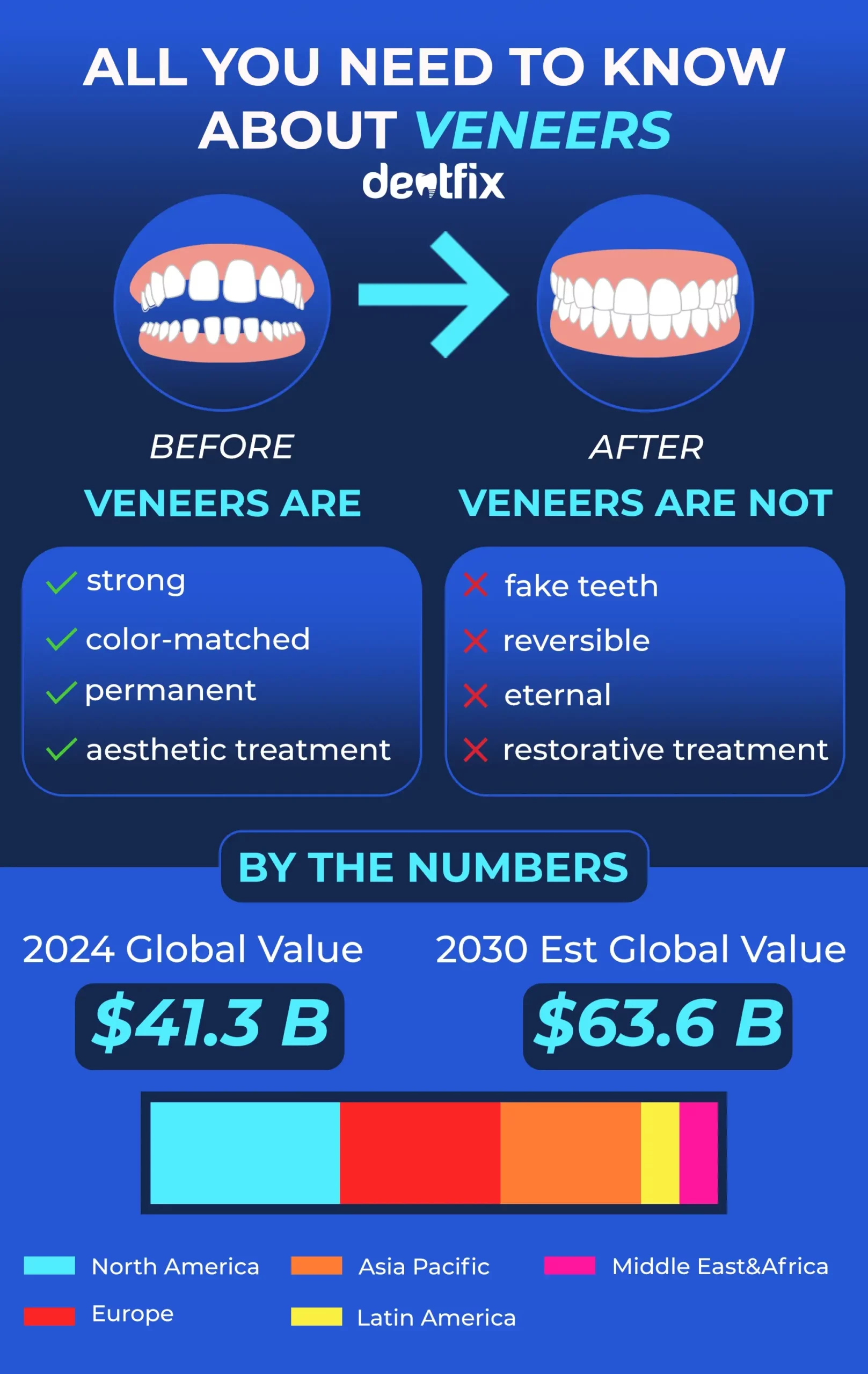 What are dental veneers