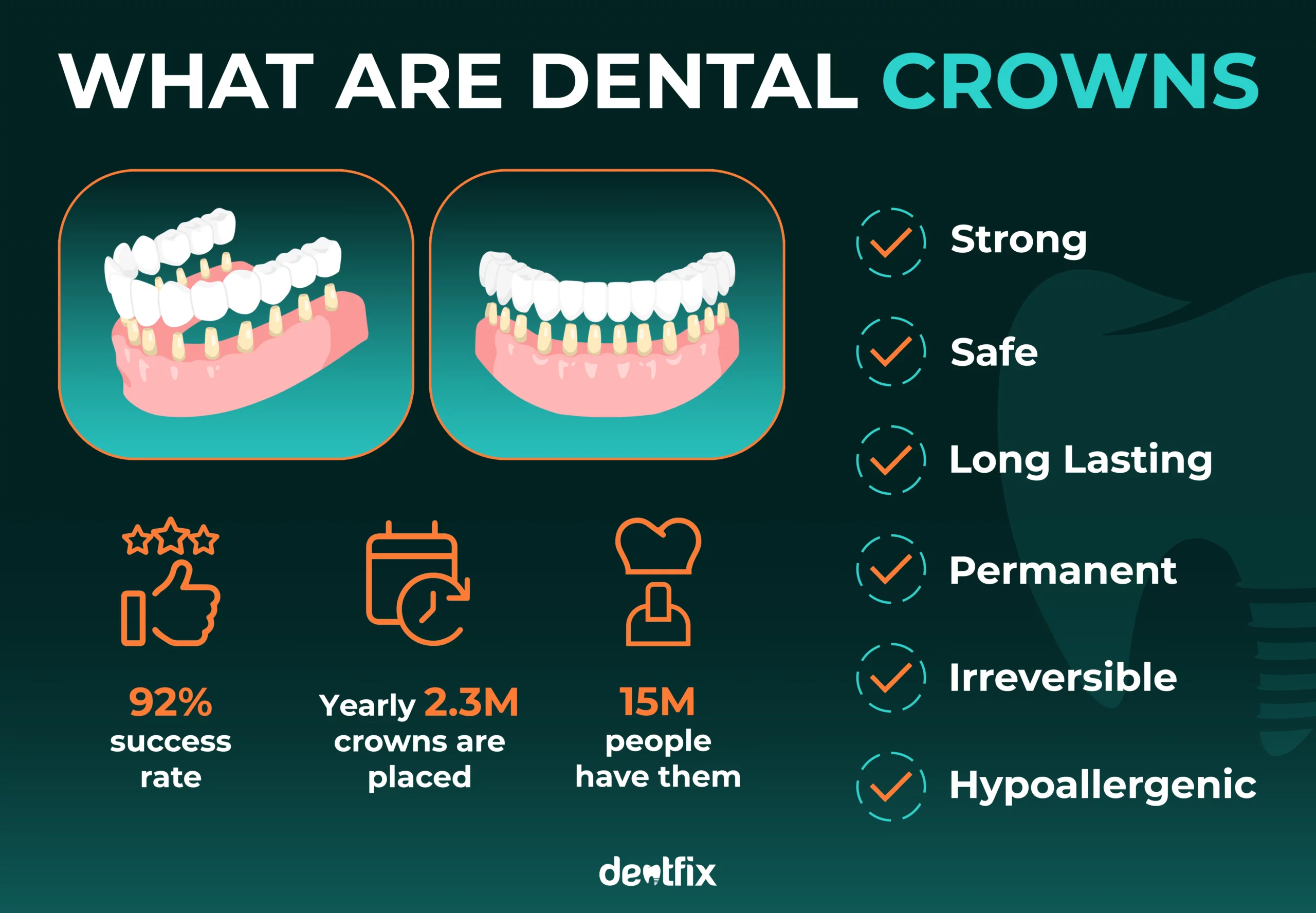 DENTAL CROWNS DEFINITION