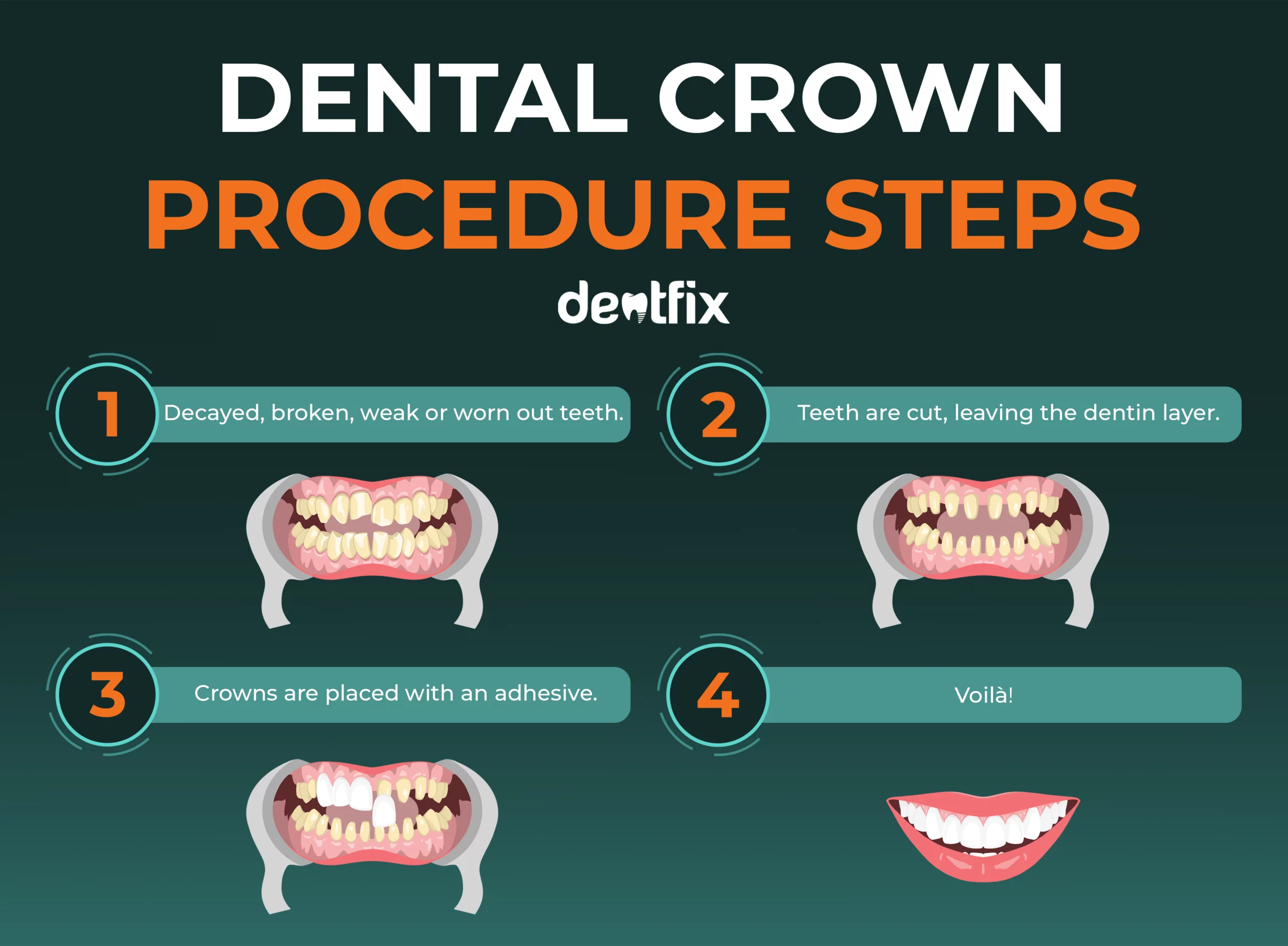 dental crown procedure