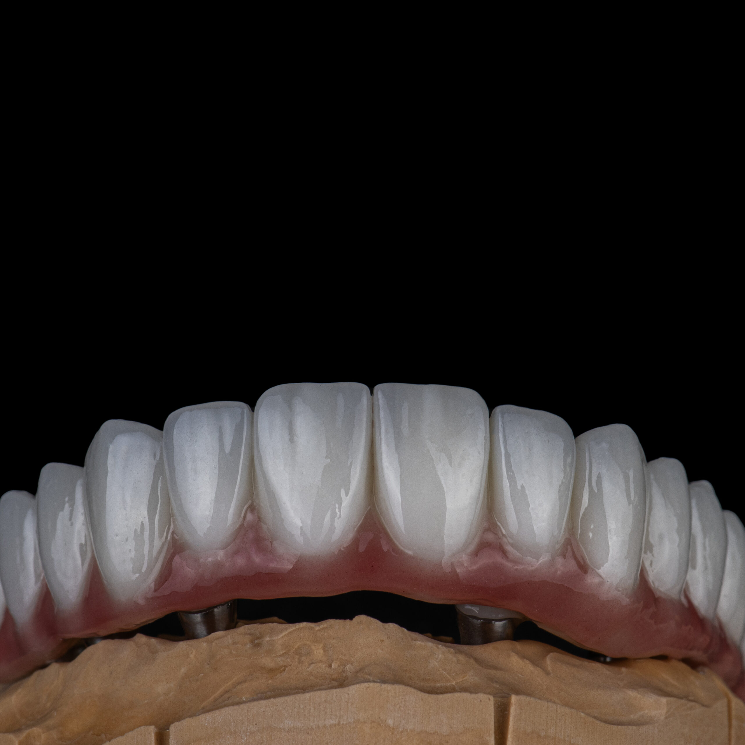 Implants and Zirconium Dentures