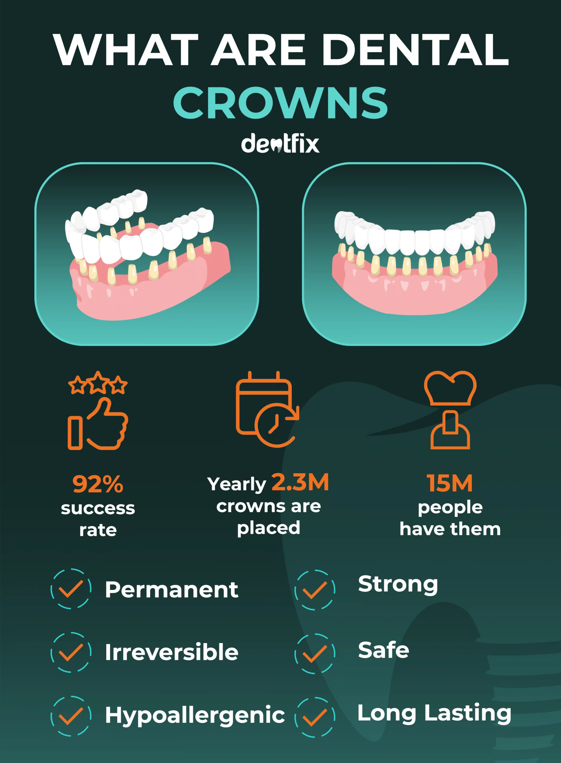 What Are Dental Crowns