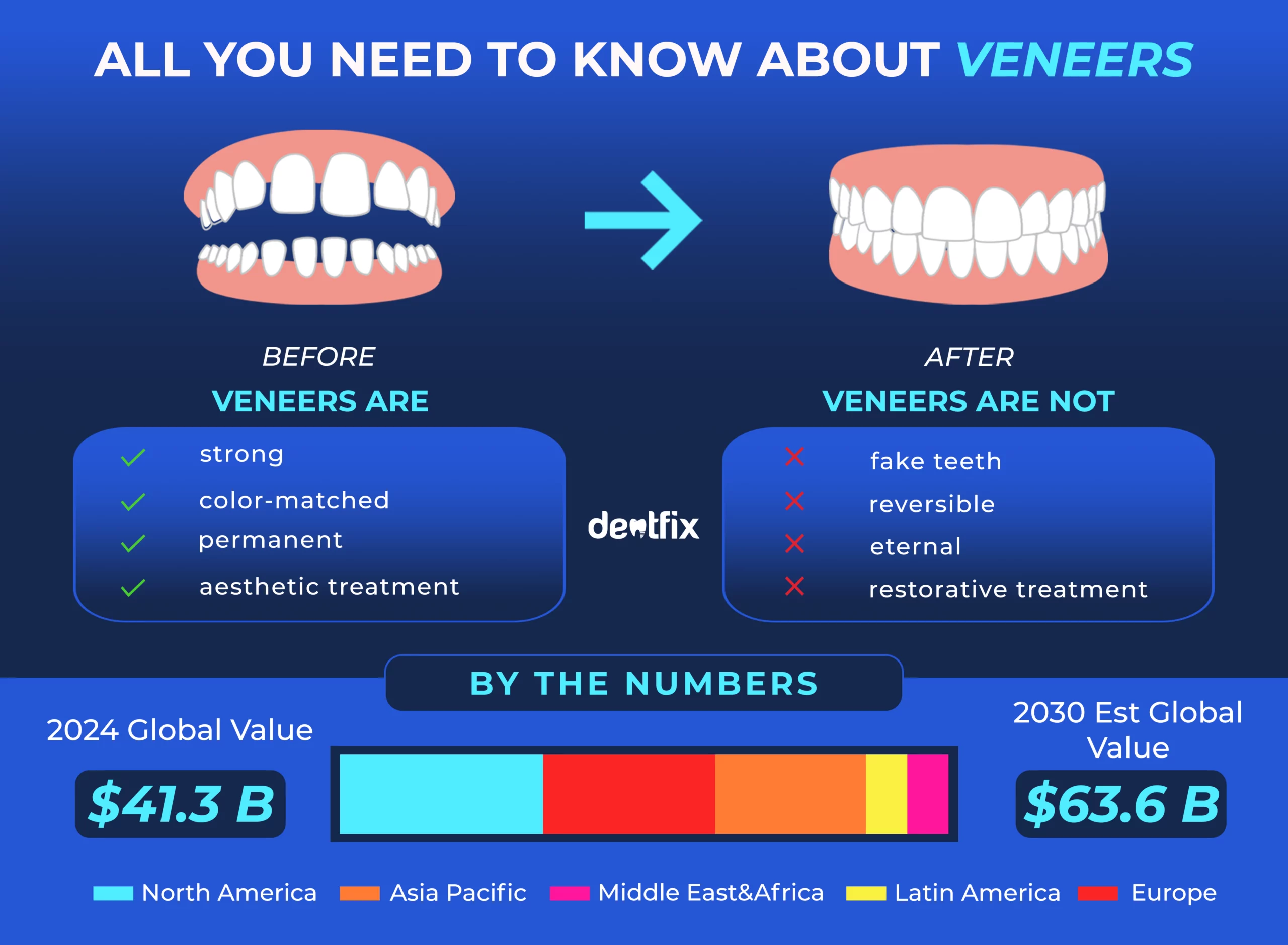 What are dental veneers